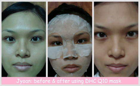 before & after Q10 mask