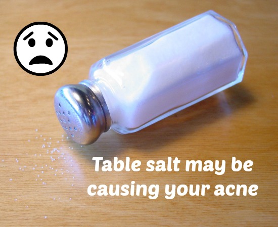 table-salt-causing-your-acne