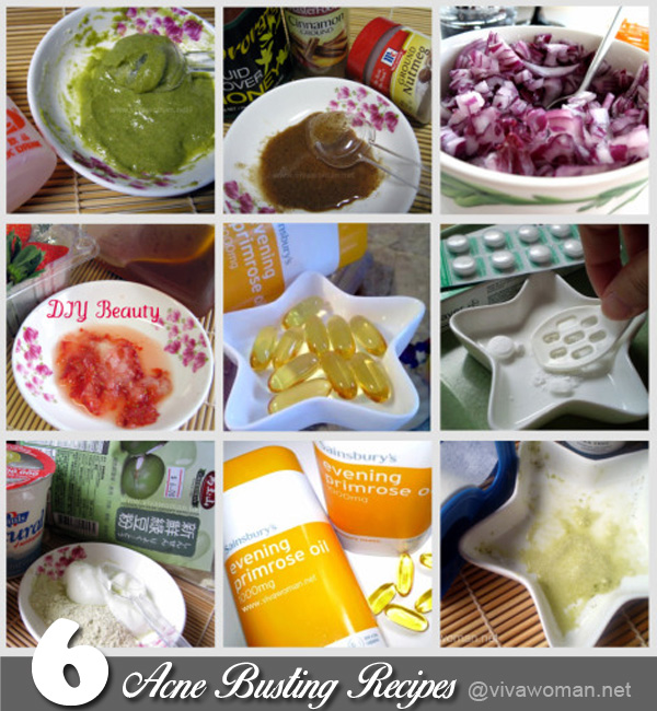 DIY-acne-recipes