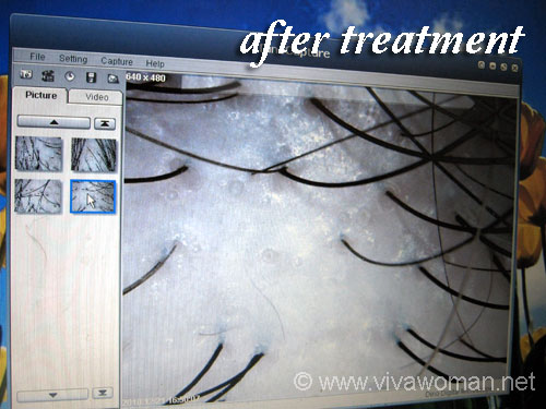 Neeta's Herbal Ayuvedics hair loss treatment |