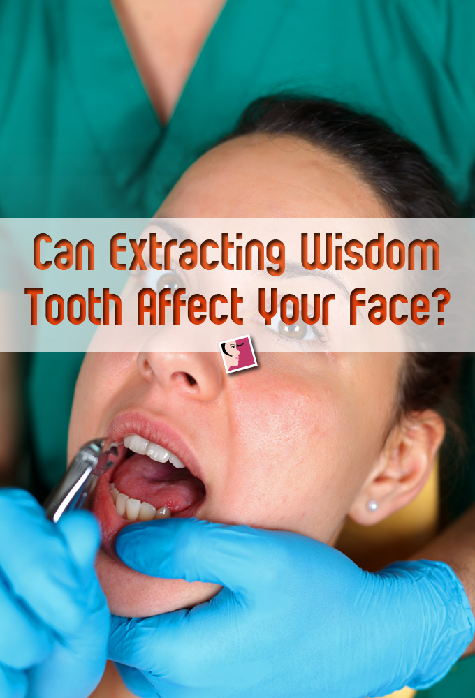 How Can Extracting Wisdom Tooth Affect Your Face