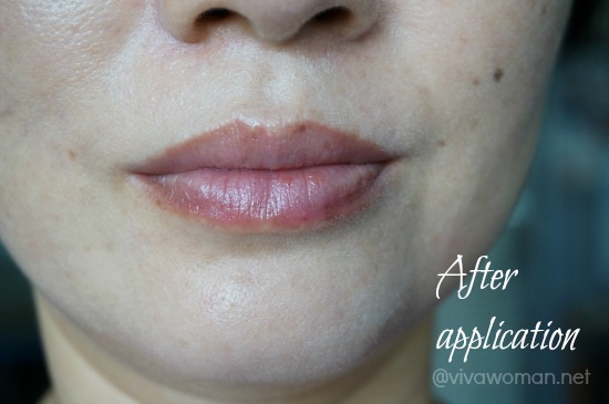 After Using MVO Pacific Lip Treatment