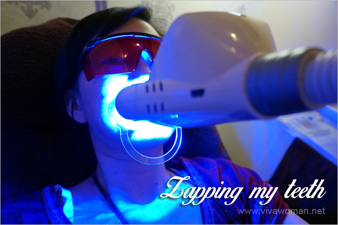 LED-Teeth-Whitening-Process