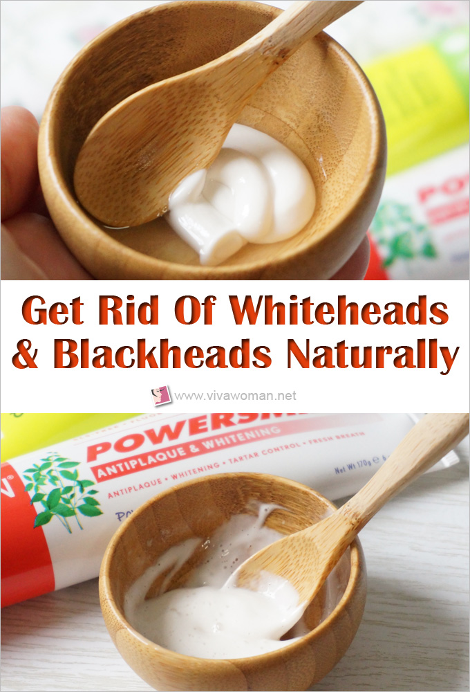 the-diy-method-to-get-rid-of-whiteheads-blackheads-naturally